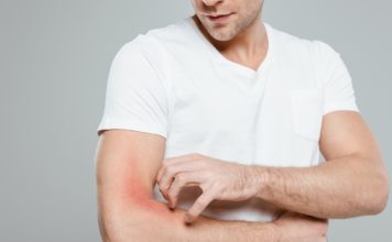 Mit lehet tenni a stressz okozta bőrproblémák ellen? stressz okozta bőrproblémák